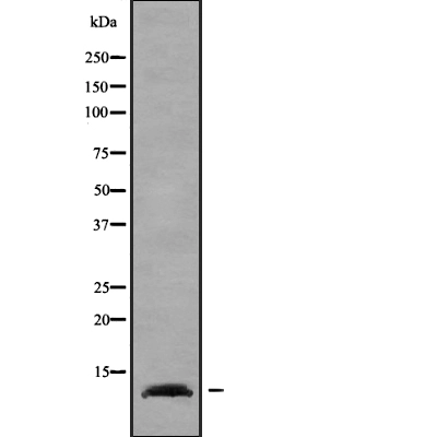 WB analysis of HUVEC cell lysates using GTX00801 ELOF1 antibody.