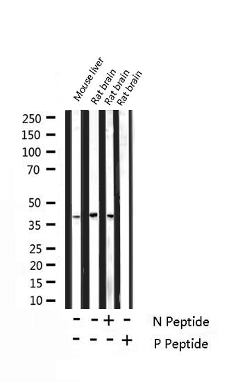 WB analysis of mouse liver and rat brain tissue lysates using GTX00803 DARPP-32 (phospho Thr75) antibody pre-incubated with phospho- or non-phospho- peptide.<br>P-peptide : phospho-peptide<br>N-peptide : non-phospho-peptide