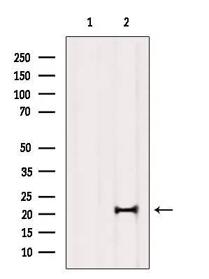 WB analysis of mouse brain tissue lysate using GTX00806 MED29 antibody. The lane on the left was treated with blocking peptide.