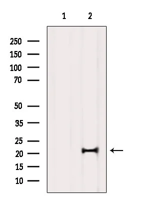 WB analysis of mouse brain tissue lysate using GTX00806 MED29 antibody. The lane on the left was treated with blocking peptide. WB analysis of mouse brain tissue lysate using GTX00806 MED29 antibody. The lane on the left was treated with blocking peptide.