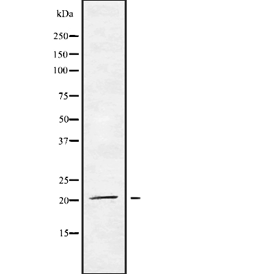 WB analysis of HT29 cell lysates using GTX00806 MED29 antibody.