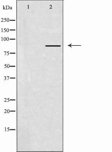 WB analysis of A549 cell lysate using GTX00807 CLCN7 antibody. The lane on the left was treated with the antigen-specific peptide.