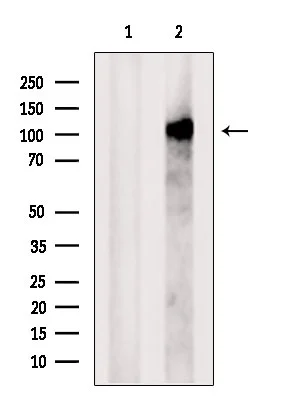 WB analysis of HeLa cell lysate using GTX00808 PACS2 antibody. The lane on the left was treated with blocking peptide.