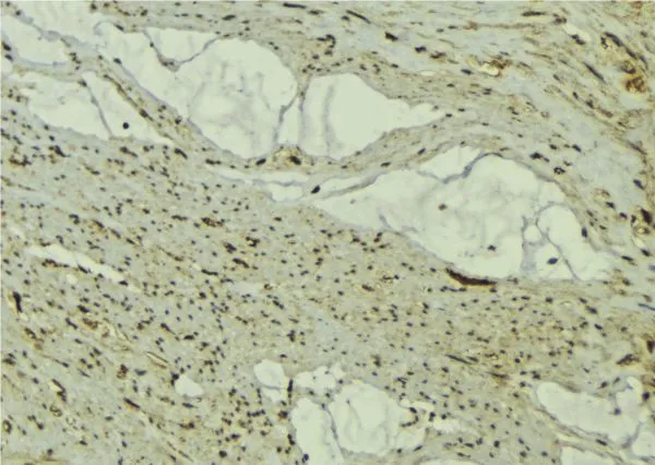 IHC-P analysis of mouse muscle tissue using GTX00810 FBXO32 Antibody.<br>Antigen retrieval : Heat mediated antigen retrieval step in citrate buffer<br>Dilution : 1:100