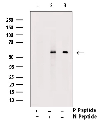 WB analysis of mouse thymus tissue lysate using GTX00812 RUNX2 (phospho Ser340) antibody pre-incubated with phospho- or non-phospho- peptide.<br>P-peptide : phospho-peptide<br>N-peptide : non-phospho-peptide
