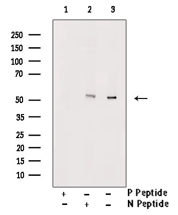 WB analysis of mouse thymus tissue using GTX00813 RUNX2 (phospho Ser275) antibody pre-incubated with phospho- or non-phospho- peptide.<br>P-peptide : phospho-peptide<br>N-peptide : non-phospho-peptide