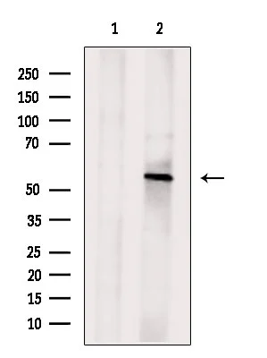 WB analysis of myeloma cells using OSBPL2 Antibody. The lane on the left was treated with blocking peptide.