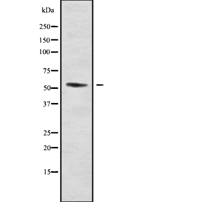 WB analysis of HT-29 cell lysate using GTX00815 DMRTA1 antibody.