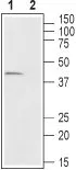 WB analysis of mouse colon tissue lysate using GTX00816 GPR43 antibody.<br>Lane 1 : Primary antibody<br>Lane 2 : Primary antibody preincubated with the negative control antigen<br>Dilution : 1:200