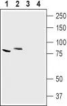 WB analysis of mouse kidney (lanes 1 and 3) and rat brain (lanes 2 and 4) tissue lysates using GTX00817 CLCN7 antibody.<br>Lane 1, 2 : Primary antibody<br>Lane 3, 4 : Primary antibody preincubated with the negative control antigen<br>Dilution : 1:200