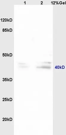WB analysis of various sample lysates using GTX00819 Pentraxin 3 antibody.<br>Lane 1 : mouse embryo<br>Lane 2 : mouse brain<br>Dilution : 1:200