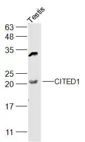 WB analysis of rat testis tissue lysate using GTX00820 CITED1 antibody.<br>Dilution : 1:500