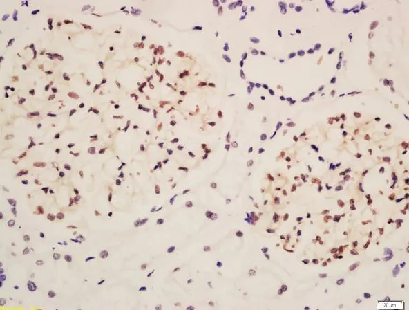 IHC-P analysis of human kidney tissue using GTX00821 NPHS2 antibody. Dilution : 1:200 IHC-P analysis of human kidney tissue using GTX00821 NPHS2 antibody. Dilution : 1:200