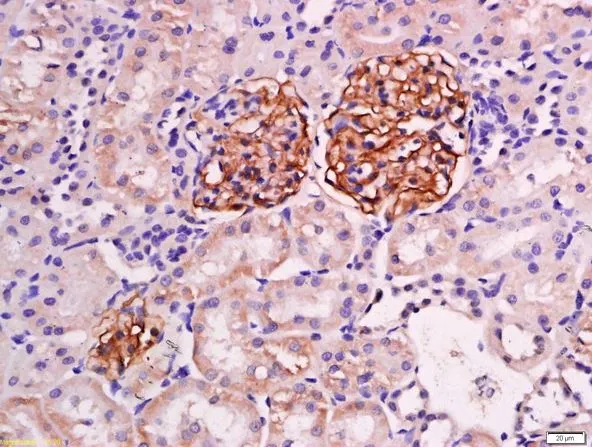 IHC-P analysis of mouse kidney tissue using GTX00821 NPHS2 antibody. Antigen retrieval : Boiling in sodium citrate buffer(pH6) for 15min Dilution : 1:200