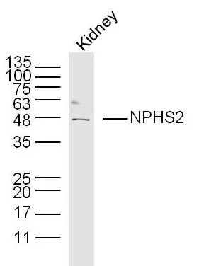 WB analysis of mouse kidney tissue lysate using GTX00821 NPHS2 antibody. Dilution : 1:300