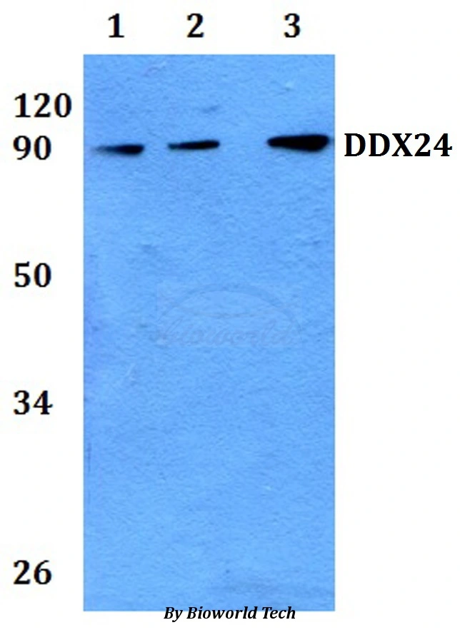 WB analysis of various sample lysates using GTX00825 DDX24 antibody.<br>Lane 1 : A549 whole cell lysate<br>Lane 2 : PC12 whole cell lysate<br>Lane 3 : sp2/0 whole cell lysate<br>Dilution : 1:500
