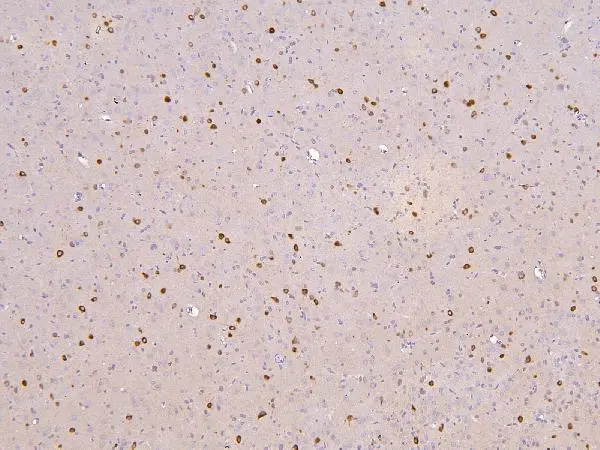 IHC-P analysis of rat brain tissue using GTX00828 RBMS3 antibody. Antigen retrieval : Heat mediated antigen retrieval was performed in citrate buffer (pH6, epitope retrieval solution) for 20 mins Dilution : 1microg/mL