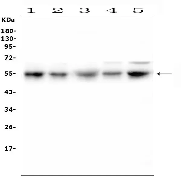 WB analysis of various sample lysates using GTX00828 RBMS3 antibody. Lane 1 : U2OS whole cell lysates Lane 2 : PC-3 whole cell lysates Lane 3 : U-87MG whole cell lysates Lane 4 : A549 whole cell lysates Lane 5 : HeLa whole cell lysates Dilution : 0.5microg/mL Loading : 50microg of sample under reducing condition