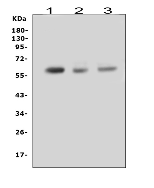 WB analysis of various sample lysates using GTX00829 RUNX2 antibody.<br>Lane 1 : U-87MG whole cell lysate<br>Lane 2 : rat liver tissue lysate<br>Lane 3 : mouse liver tissue lysate<br>Dilution : 0.5?g/mL<br>Loading : 50?g of sample under reducing condition