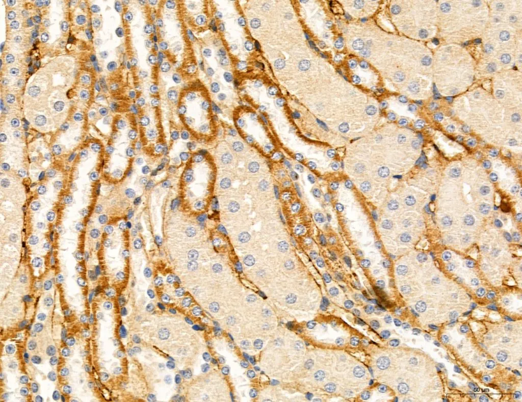 IHC-P analysis of mouse kidney tissue using GTX00840 TGF beta Receptor I antibody. The sample was formaldehyde fixed and a heat mediated antigen retrieval step in citrate buffer was performed.<br>Dilution : 1:100