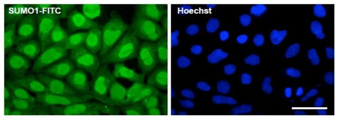 ICC/IF analysis of HEK293A cell using GTX00842 SUMO1 antibody [4D12] (FITC).<br>Scale bar : 50 mm<br>Dilution : 1:50