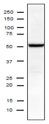 WB analysis of MDCK cells infected with Influenza A virus (H1N1, PuertoRico/8/34) using GTX00858 Influenza A virus NP (nucleoprotein) antibody [C43]. Dilution : 1:1000 SDS-PAGE : 10-20% gradient gel