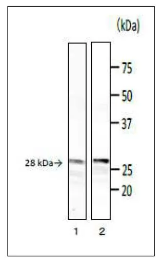WB analysis of various samples using GTX00866 Bacillus cereus phospholipase C antibody [bc-01].<br>Lane 1 : Culture medium of B. cereus<br>Lane 2 : PC-PLC purified from B. cereus<br>Dilution : 1:1000