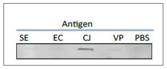 Test of reactivity of GTX00867 Campylobacter Porin antibody [cj-01] with several food poisoning bacteria in slot blot test. Extract of each strain of food poisoning bacteria was coated onto 5 areas of a nitrocellulose membrane and reacted with GTX00867. GTX00867 specifically reacts with extract of C. jejuni. SE: Salmonella Enteritidis EC: Escherichia coli CJ: C. jejuni VP: Vibrio parahaemolyticus