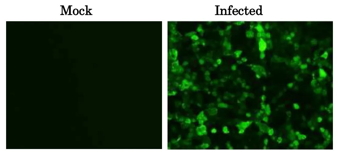 ICC/IF analysis of MDCK cells infected with Influenza B virus (B/Florida/4/2006 virus) using GTX00869 Influenza B Virus M1 antibody [6A11]. This antibody efficiently detected the viruses in the infected MDCK cells with B/Florida/4/2006 virus. Fixation : 4% PFA in PBS Permeabilization : 0.1% Triton X-100 in PBS Dilution : 1:100