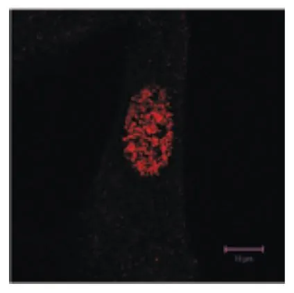 ICC/IF analysis of TIG-1 cells using GTX00874 GAK antibody [9-10]. Dilution : 1:50