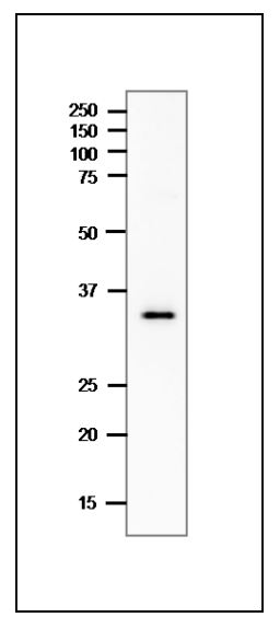 WB analysis of crude extract of C. perfringens using GTX00879 Clostridium perfringens enterotoxin (CPE) antibody.<br>Dilution : 1 ?g/ml<br>SDS-PAGE : 12.5%