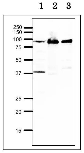 WB analysis of various samples using GTX00883 RRM1 antibody. Lane 1 : Xenopus egg tissue lysate Lane 2 : HeLa whole cell lysate Lane 3 : Chinese Hamster Ovary cell lysate Dilution : 1:1000 SDS-PAGE : 12.5% WB analysis of various samples using GTX00883 RRM1 antibody. Lane 1 : Xenopus egg tissue lysate Lane 2 : HeLa whole cell lysate Lane 3 : Chinese Hamster Ovary cell lysate Dilution : 1:1000 SDS-PAGE : 12.5%