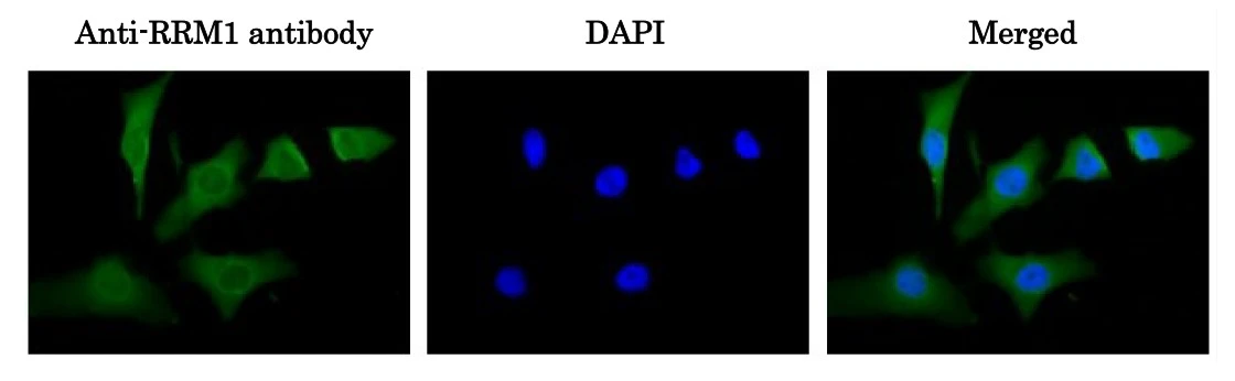 ICC/IF analysis of HeLa cells using GTX00883 RRM1 antibody. Localization is mainly cytoplasm. Fixation : 4% PFA Permeabilization : 0.25% Triton X-100 Dilution : 1:100