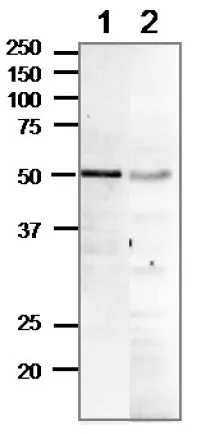 WB analysis of various samples using GTX00884 Rad52 antibody. Lane 1 : MCF-7 whole cell lysate (16 microg) Lane 2 : PC-12 whole cell lysate (40 microg) Dilution : 1:1000 SDS-PAGE : 12.5%