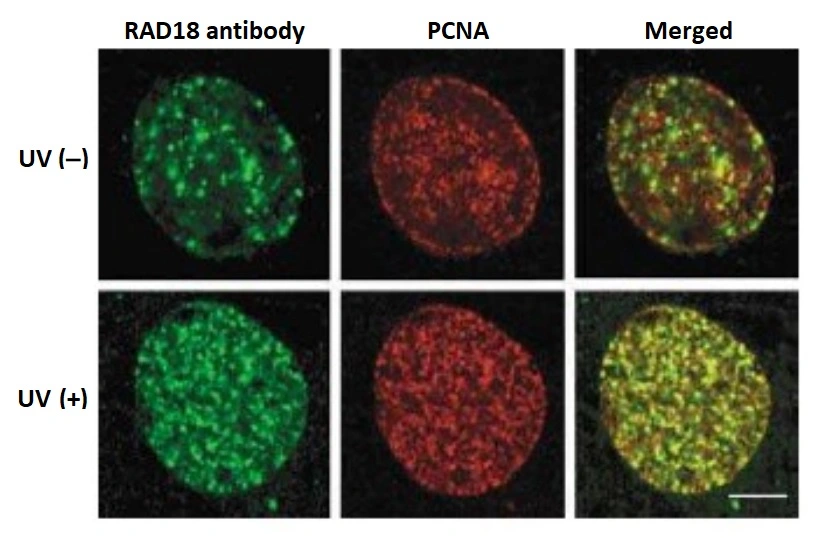 ICC/IF analysis of GM637 cells were irradiated with/without UV (15/m2) for 4 hrs using GTX00886 RAD18 antibody. Fixation : Methanol Dilution : 1:250