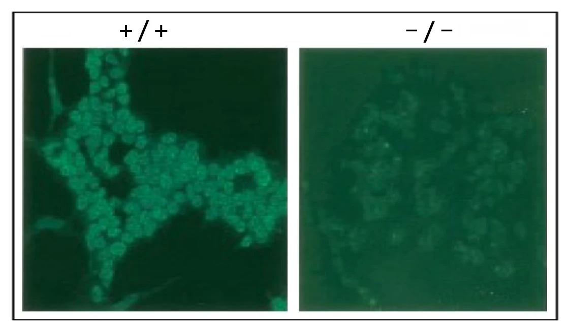 ICC/IF analysis of Wild-type (+/+) and RAD18 knock-out mouse ES cells (-/-) using GTX00887 RAD18 antibody. Prefixed 4% PFA and fixed with 80% methanol