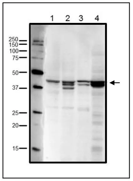 WB analysis of various samples using GTX00888 RRM2 antibody. Multiple bands are due to phosphorylation at Ser20 and/or Thr33 (human sequence). Lane 1 : HeLa whole cell lysate Lane 2 : MCF-7 whole cell lysate Lane 3 : NIH-3T3 whole cell lysate Lane 4 : Xenopus eggs at mitotic stage Dilution : 1:1000 Loading : 20 microg WB analysis of various samples using GTX00888 RRM2 antibody. Multiple bands are due to phosphorylation at Ser20 and/or Thr33 (human sequence). Lane 1 : HeLa whole cell lysate Lane 2 : MCF-7 whole cell lysate Lane 3 : NIH-3T3 whole cell lysate Lane 4 : Xenopus eggs at mitotic stage Dilution : 1:1000 Loading : 20 microg