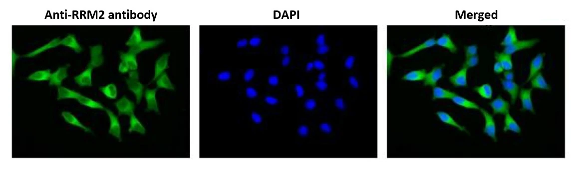 ICC/IF analysis of MCF-7 cells using GTX00888 RRM2 antibody. Fixation : 4% PFA Permeabilization : 0.25% Triton X-100 Dilution : 1:100