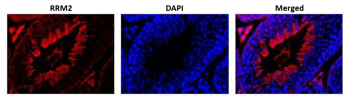 IHC-P analysis of mouse testis tissue section using GTX00888 RRM2 antibody. RRM2 is abundantly expressed in actively proliferating cells. Dilution : 1:300