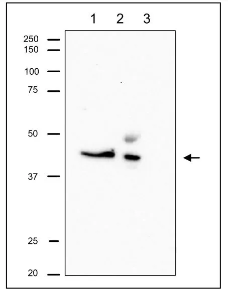 IP analysis of CHO whole cell lysate using GTX00888 RRM2 antibody. The upper band in lane 2 is IgG heavy chain. Lane 1 : Input Lane 2 : The immunoprecipitate with the antibody Lane 3 : Supernatant of immuno-precipitation IP antibody : 1:1000 IB antibody : 1:500