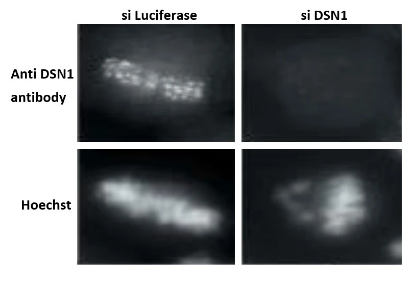 ICC/IF analysis of HeLa cells using GTX00889 DSN1 antibody. Mitotic cells were accumulated by nocodazole treatment and chromosomes were spread on coverglass. Left : Cells transfected with luciferase siRNA (as a control) Right : Cells transfected with DSN1 siRNA