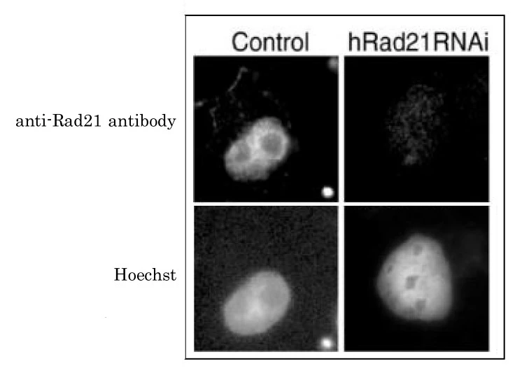 ICC/IF analysis of HeLa cells transfected with control or specifc hRad21 siRNA using GTX00890 Rad21 antibody.<br>Fixation : 4% PFA<br>Permeabilization : 0.5% Triton X-100