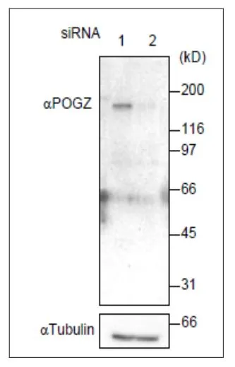 WB analysis of HeLa cells transfected with control or POGZ specific siRNA using GTX00892 Pogz antibody.<br>Lane 1 : Cells transfected with control siRNA<br>Lane 2 : Cells transfected with POGZ specific siRNA<br>Dilution : 1:1000