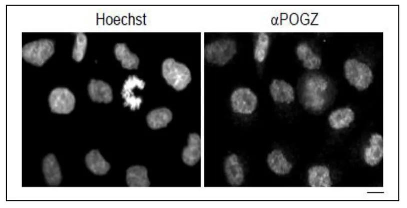 ICC/IF analysis of HeLa cells using GTX00892 Pogz antibody. Scale bar : 10 microm Fixation : 4% PFA Dilution : 1:500