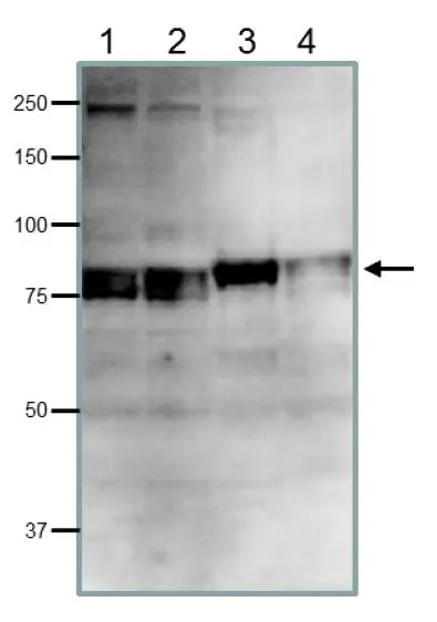 WB analysis of various samples using GTX00893 CDT2 antibody. Doublet bands reflect post-translational phospholylation. Lane 1 : HeLa whole cell lysate Lane 2 : MCF-7 whole cell lysate Lane 3 : NIH-3T3 whole cell lysate Lane 4 : CHO whole cell lysate Dilution : 1:200 Loading : 40 microg WB analysis of various samples using GTX00893 CDT2 antibody. Doublet bands reflect post-translational phospholylation. Lane 1 : HeLa whole cell lysate Lane 2 : MCF-7 whole cell lysate Lane 3 : NIH-3T3 whole cell lysate Lane 4 : CHO whole cell lysate Dilution : 1:200 Loading : 40 microg