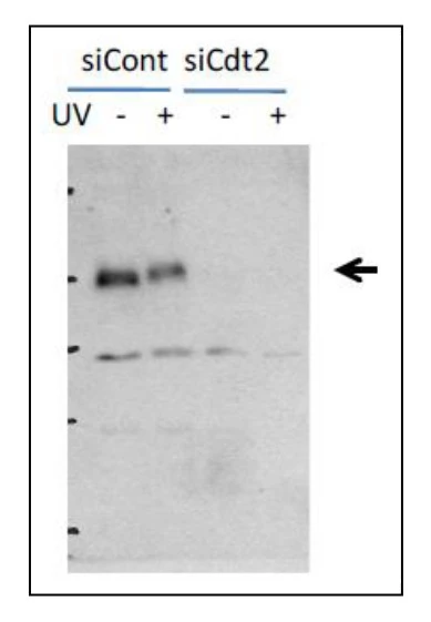 WB analysis of HeLa cells were transfected with control or Cdt2 siRNA using GTX00893 CDT2 antibody. Cdt2 is phosphorylated after UV irradiation as shown by the band shift-up in irradiated sample (UV +).