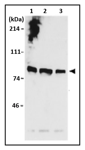 WB analysis of various samples using GTX00894 MCM7 antibody.<br>Lane 1 : SiHa whole cell lysate<br>Lane 2 : C33A whole cell lysate<br>Lane 3 : WI38 whole cell lysate