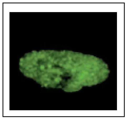 ICC/IF analysis of G1 phase HeLa cell nucleus using GTX00894 MCM7 antibody. The HeLa cells was treated with protein cross-linking reagent, DSP and chromatin extraction. Photographed with confocal microscope. Fixation : 4% PFA