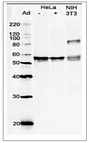 WB analysis of various samples using GTX00895 GRWD1 antibody.<br>Lane 1 : untreated HeLa cells<br>Lane 2 : HeLa cells treated with adriamycin<br>Lane 3 : NIH-3T3 whole cell lysate<br>Dilution : 1:1000<br>Loading : 10 ?g