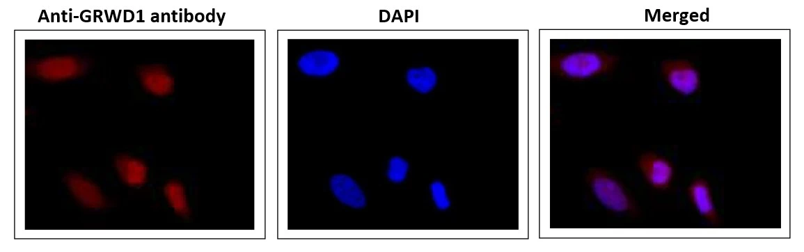 ICC/IF analysis of HeLa cells using GTX00895 GRWD1 antibody. Fixation : 4% PFA, overnight Permeabilization : 0.25% Triton X-100 in PBS, 10 min Dilution : 1:1000